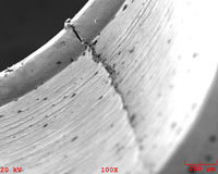A fracture at low magnification.